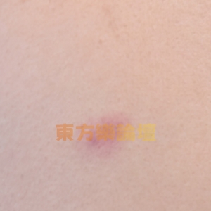 玖玖